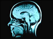 Brain Injury Case Management